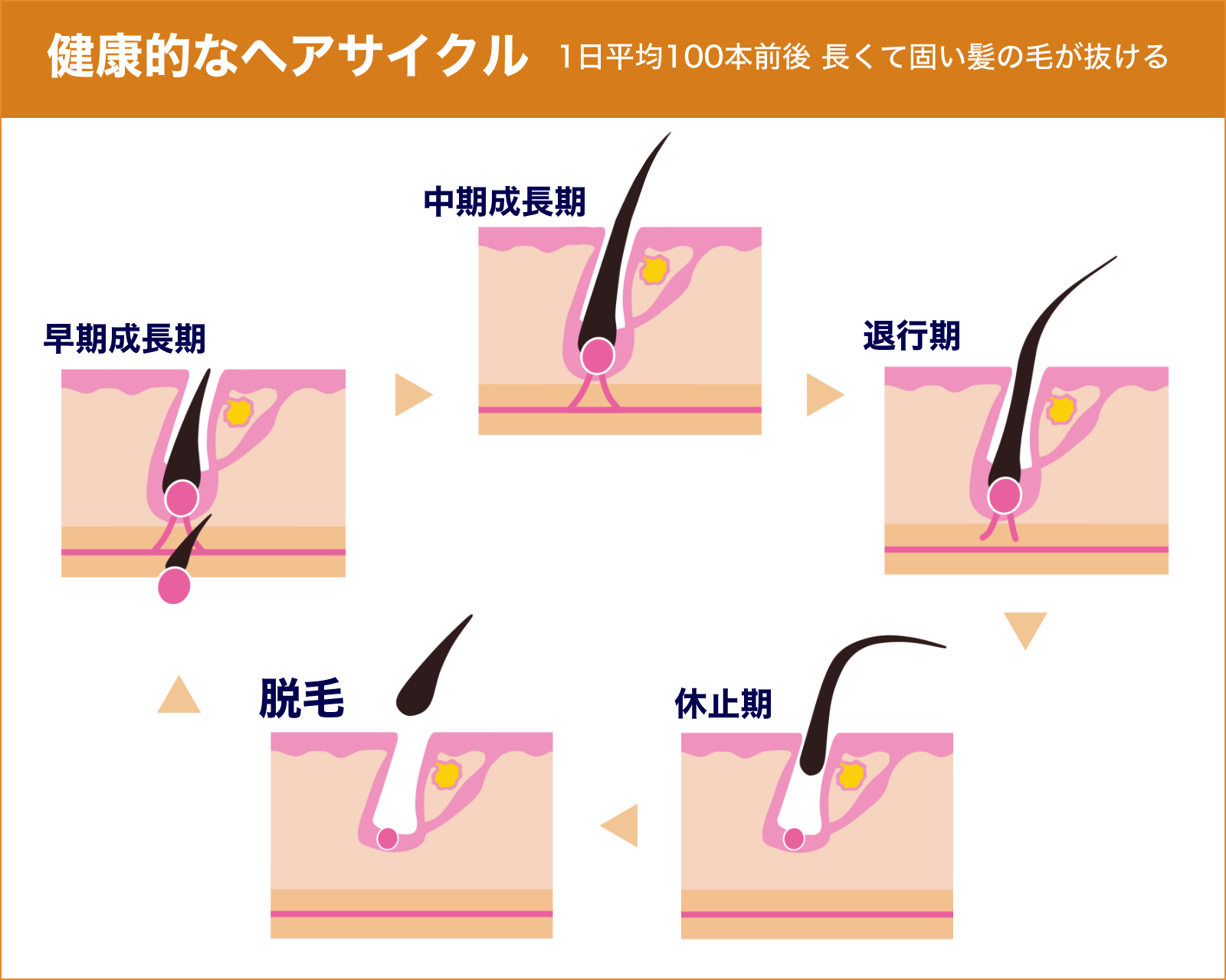 健康的なヘアサイクル（1日平均100本前後 長くて固い髪の毛が抜ける）