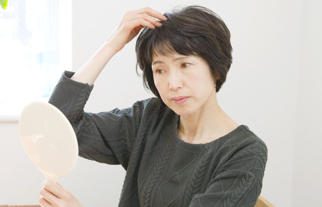 FAGA(女性男性型脱毛症)とは…？【FAGA基礎知識】