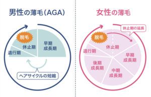 ヘアサイクル（毛周期）が乱れる原因【FAGA基礎知識】