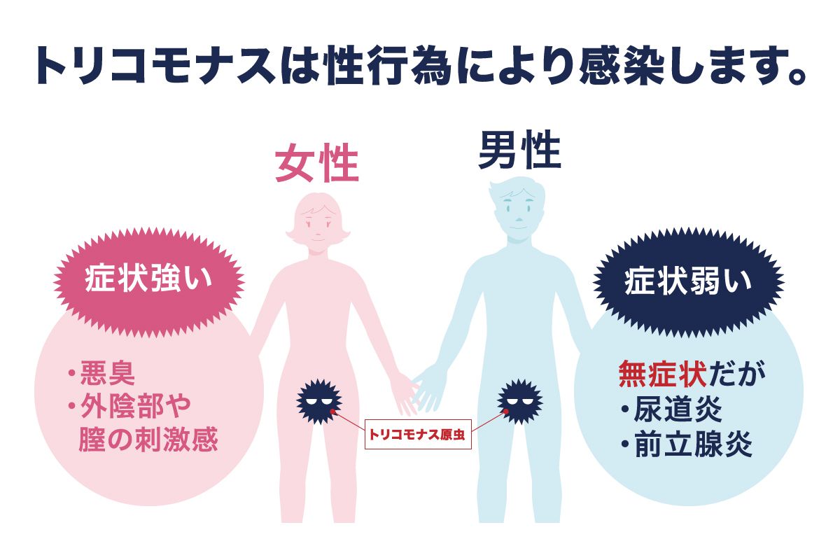 トリコモナス症の原因は何ですか?