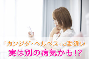 カンジダ・ヘルペス